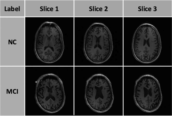 https://cdn.ncbi.nlm.nih.gov/pmc/blobs/53cf/6240705/0682667fc588/gr1.jpg