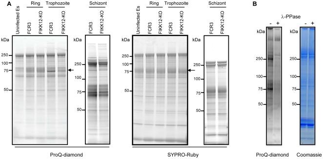 https://cdn.ncbi.nlm.nih.gov/pmc/blobs/53d4/2909202/779b8a84692b/pone.0011747.g004.jpg