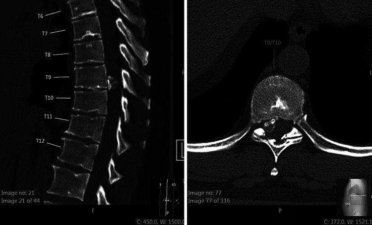 https://cdn.ncbi.nlm.nih.gov/pmc/blobs/53d6/9245764/c41a8d3a8a30/CASE2130f1.jpg