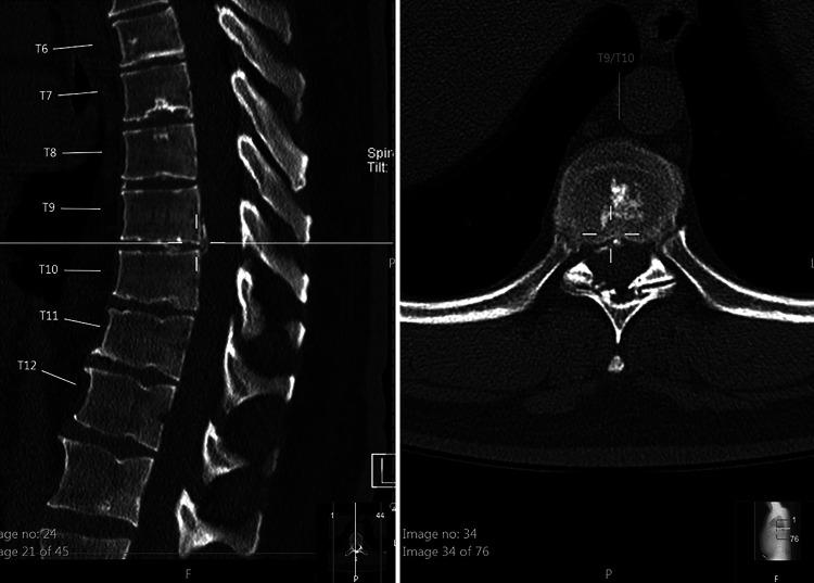 https://cdn.ncbi.nlm.nih.gov/pmc/blobs/53d6/9245764/fc08ab482d68/CASE2130f2.jpg
