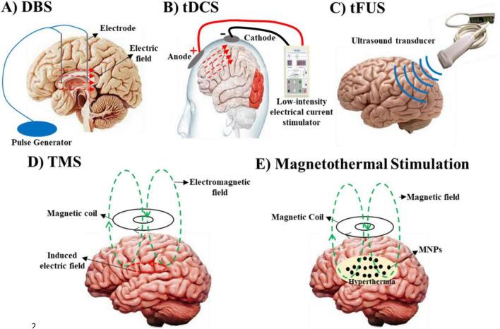 https://cdn.ncbi.nlm.nih.gov/pmc/blobs/53dc/12066545/bfdf4e5ba2e9/fnhum-19-1489940-g001.jpg