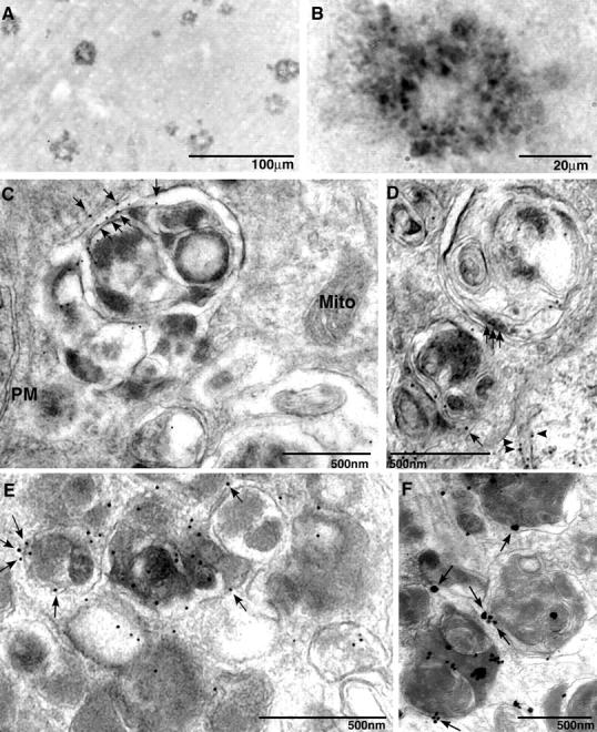 https://cdn.ncbi.nlm.nih.gov/pmc/blobs/53de/2171227/24bb0b2f166d/200505082f3.jpg