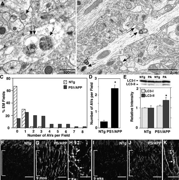 https://cdn.ncbi.nlm.nih.gov/pmc/blobs/53de/2171227/ce206c0e626a/200505082f2.jpg