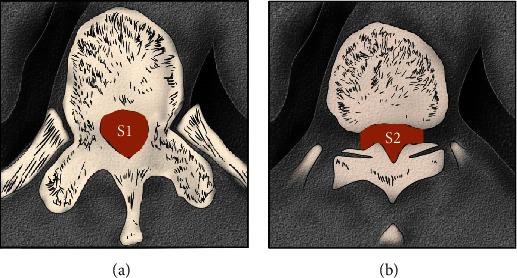 https://cdn.ncbi.nlm.nih.gov/pmc/blobs/53df/8081600/0792c8499544/BMRI2021-8410317.001.jpg