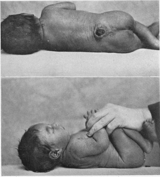 https://cdn.ncbi.nlm.nih.gov/pmc/blobs/53e8/1427121/9fe32966fffa/annsurg00753-0009-a.jpg