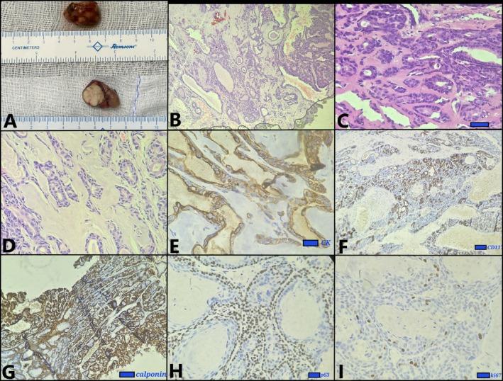 https://cdn.ncbi.nlm.nih.gov/pmc/blobs/53e9/12414803/d3f112bde88e/RCR2-13-e70333-g001.jpg