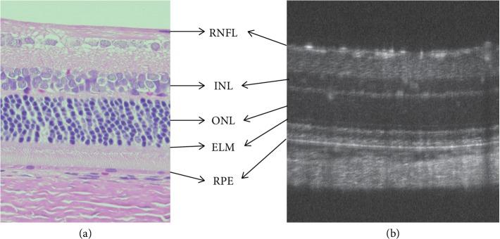 https://cdn.ncbi.nlm.nih.gov/pmc/blobs/53eb/6875330/4de989881f5b/BMRI2019-8276140.004.jpg