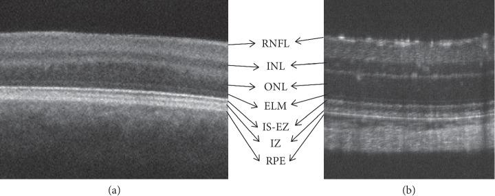 https://cdn.ncbi.nlm.nih.gov/pmc/blobs/53eb/6875330/5a60cf186fdb/BMRI2019-8276140.003.jpg
