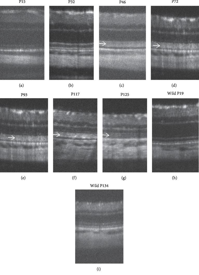 https://cdn.ncbi.nlm.nih.gov/pmc/blobs/53eb/6875330/de4db7c6512f/BMRI2019-8276140.009.jpg