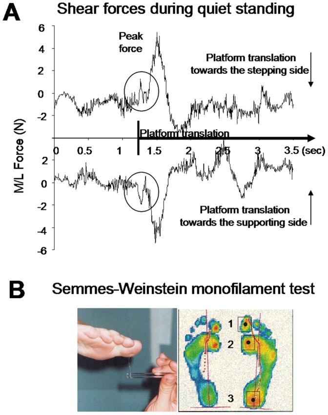 https://cdn.ncbi.nlm.nih.gov/pmc/blobs/53ec/3563658/5d21b3fcc94e/pone.0055081.g001.jpg