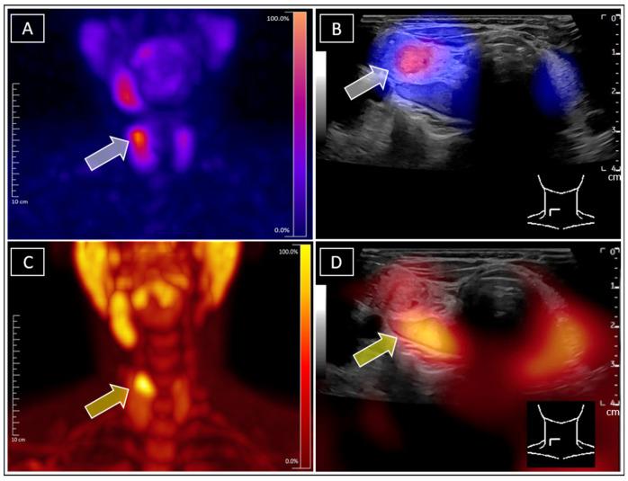 https://cdn.ncbi.nlm.nih.gov/pmc/blobs/53f5/12110229/4dce56023b78/diagnostics-15-01262-g002.jpg