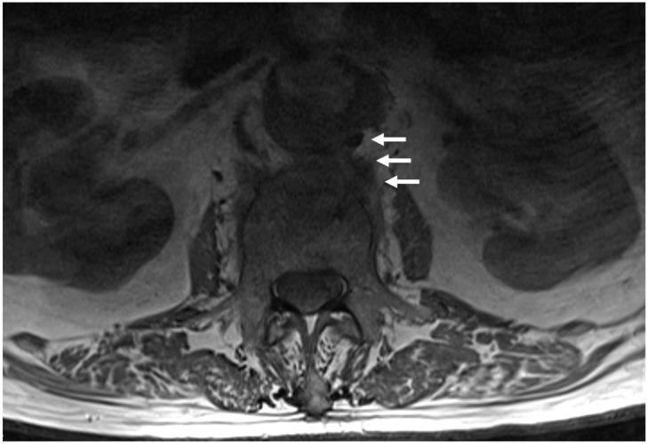 https://cdn.ncbi.nlm.nih.gov/pmc/blobs/53f9/5441139/39c64ecd2216/jbjiv02p0096g001.jpg