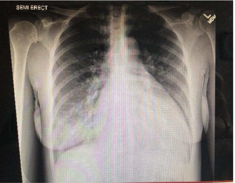 https://cdn.ncbi.nlm.nih.gov/pmc/blobs/53fb/9410703/b0a7c94f3a0f/cureus-0014-00000027312-i04.jpg
