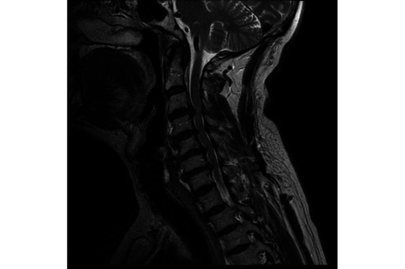 https://cdn.ncbi.nlm.nih.gov/pmc/blobs/53fd/11240080/1ec613f869b5/ijmr_v13i1e48212_fig2.jpg