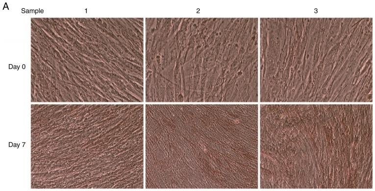https://cdn.ncbi.nlm.nih.gov/pmc/blobs/5405/6297760/e5baad658087/MMR-19-01-0103-g00.jpg