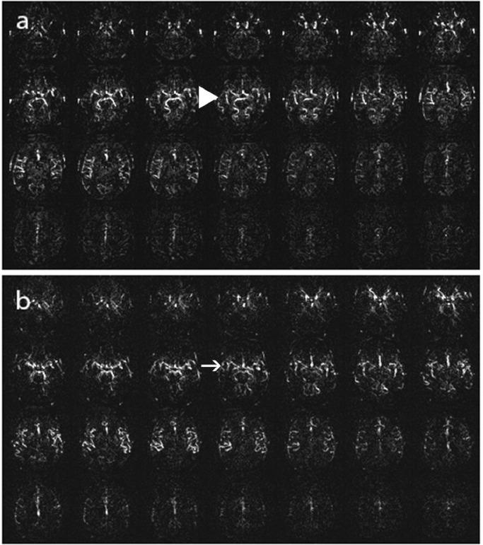 https://cdn.ncbi.nlm.nih.gov/pmc/blobs/5409/10791566/3ccd429ec533/gr5.jpg