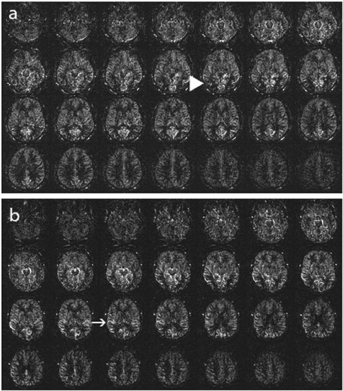 https://cdn.ncbi.nlm.nih.gov/pmc/blobs/5409/10791566/e15986c6cacf/gr2.jpg