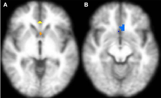 https://cdn.ncbi.nlm.nih.gov/pmc/blobs/5409/8761802/1537993fef7c/fmed-08-775344-g0005.jpg