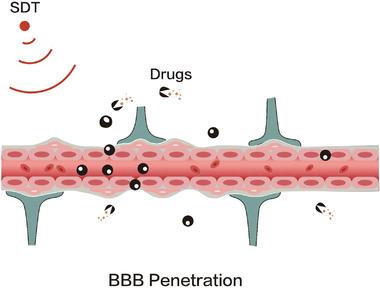 https://cdn.ncbi.nlm.nih.gov/pmc/blobs/5409/9561875/275c6bb30ba4/ADVS-9-2203921-g012.jpg