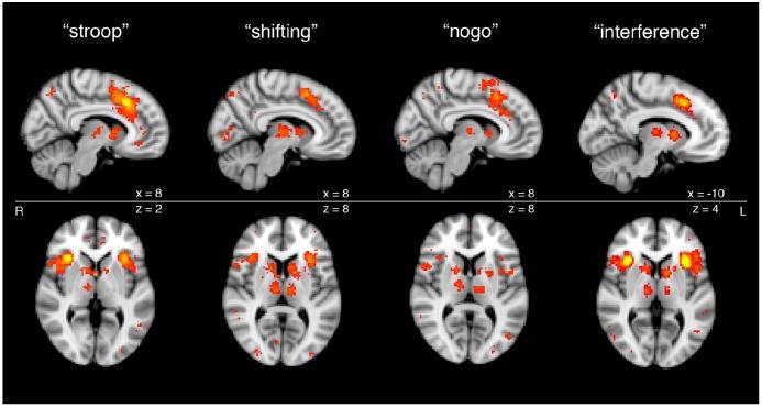 https://cdn.ncbi.nlm.nih.gov/pmc/blobs/540a/5187454/c21c713063ee/fnsys-10-00104-g0002.jpg