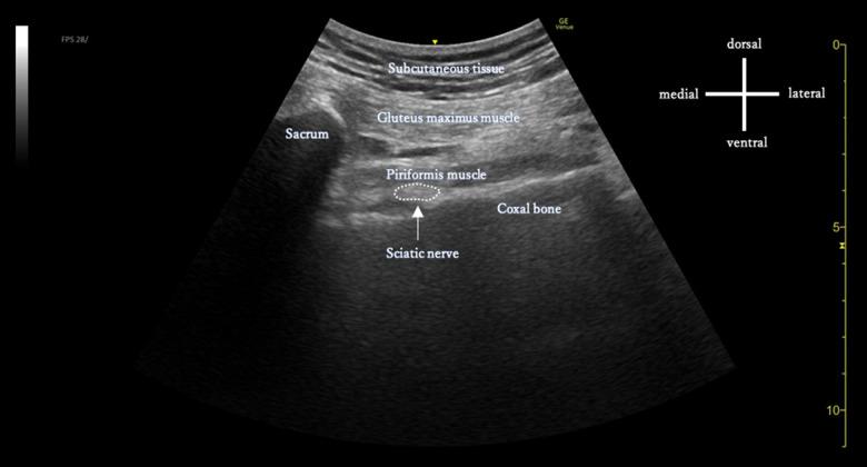 https://cdn.ncbi.nlm.nih.gov/pmc/blobs/540a/9703950/80e7cc4af283/amjcaserep-23-e938966-g001B.jpg