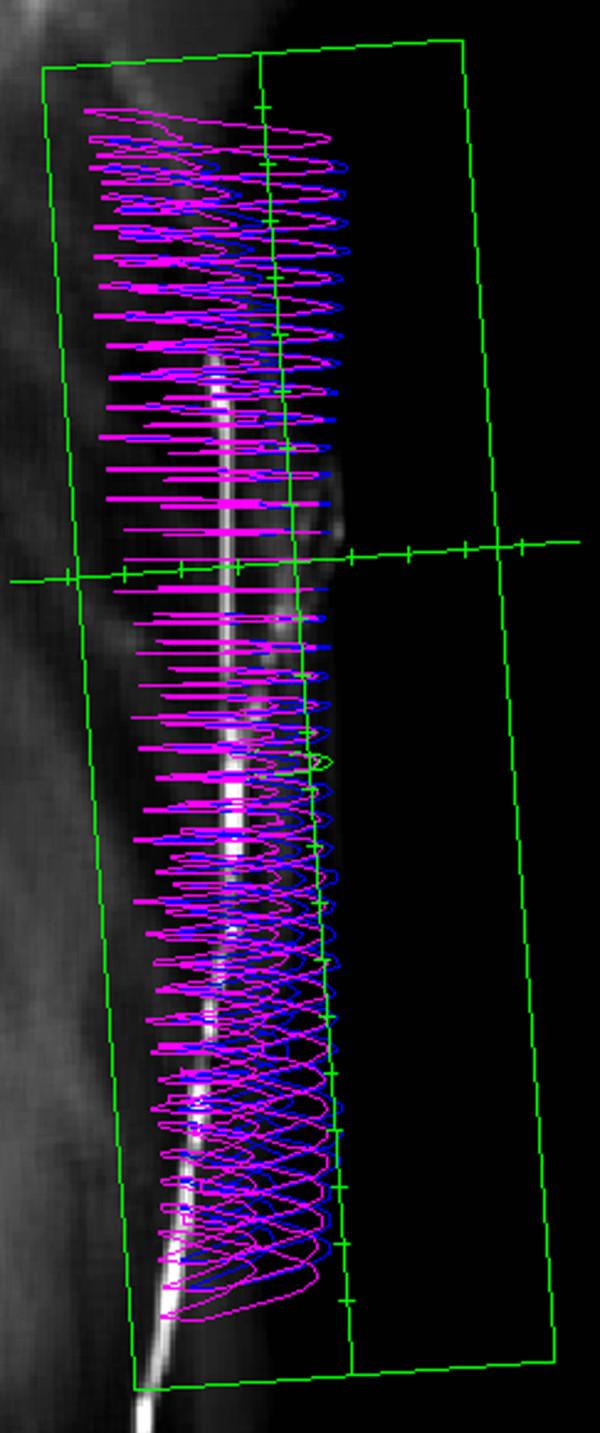 https://cdn.ncbi.nlm.nih.gov/pmc/blobs/5414/2739519/44d15f6d813a/1756-9966-28-41-2.jpg