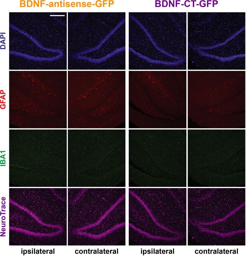 https://cdn.ncbi.nlm.nih.gov/pmc/blobs/5414/4783051/c9367c057510/pone.0150995.g003.jpg