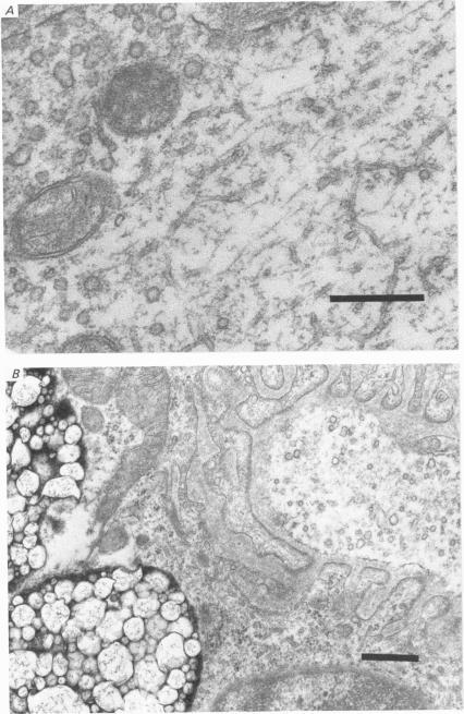 https://cdn.ncbi.nlm.nih.gov/pmc/blobs/5419/1199166/8d7a4a531b78/jphysiol00658-0388-a.jpg