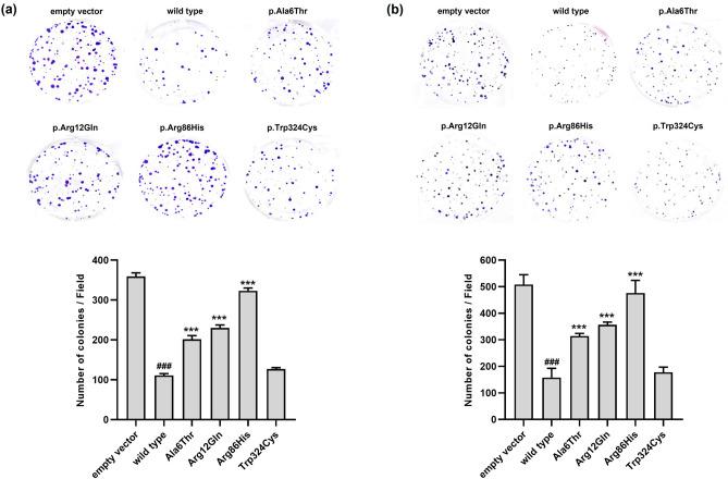 https://cdn.ncbi.nlm.nih.gov/pmc/blobs/5420/10873386/988ffdd0408e/41598_2024_54658_Fig4_HTML.jpg