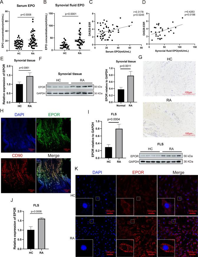 https://cdn.ncbi.nlm.nih.gov/pmc/blobs/5420/11041559/3fe1f647fe1b/ard-2023-224852f01.jpg