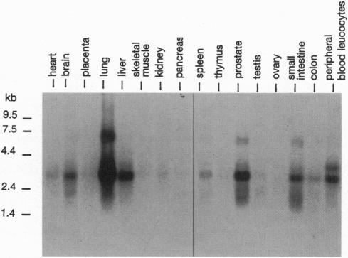 https://cdn.ncbi.nlm.nih.gov/pmc/blobs/5420/42334/820f67fd8f4f/pnas01485-0534-b.jpg