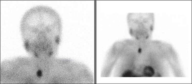 https://cdn.ncbi.nlm.nih.gov/pmc/blobs/5421/6746011/196f0f470477/MIRT-28-120-g2.jpg