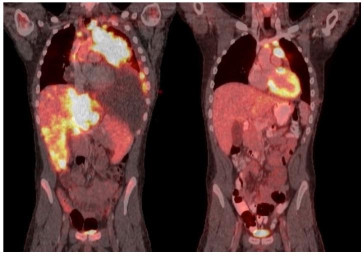 https://cdn.ncbi.nlm.nih.gov/pmc/blobs/5429/8750927/592a2aeb5ce1/cancers-14-00150-g002.jpg