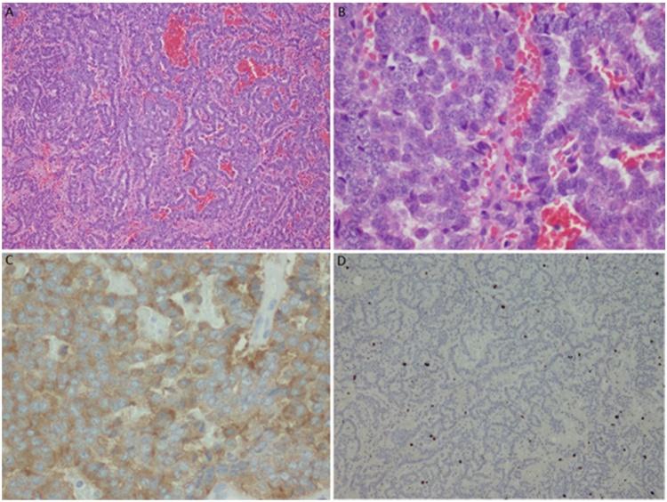 https://cdn.ncbi.nlm.nih.gov/pmc/blobs/542a/5133469/55daf5ce5d4c/gr2.jpg