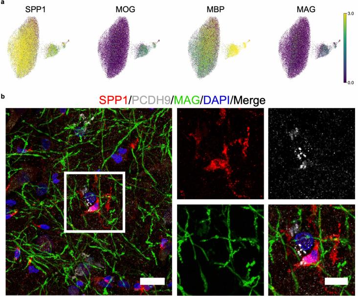 https://cdn.ncbi.nlm.nih.gov/pmc/blobs/542c/11405287/2c2734ab845b/41591_2024_3150_Fig11_ESM.jpg
