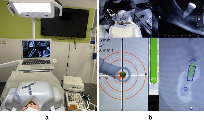 https://cdn.ncbi.nlm.nih.gov/pmc/blobs/542c/9929278/11e3562c29e5/41598_2023_29633_Fig3_HTML.jpg