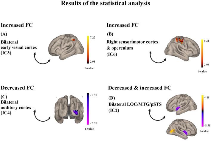 https://cdn.ncbi.nlm.nih.gov/pmc/blobs/5431/12069311/0ea8e3da8806/fnins-19-1482828-g0003.jpg