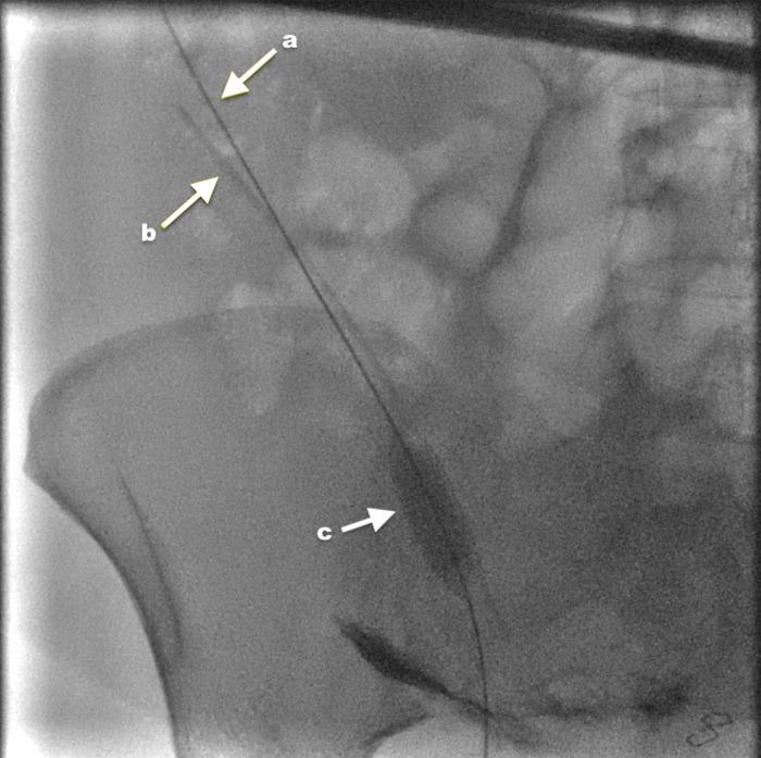 https://cdn.ncbi.nlm.nih.gov/pmc/blobs/5432/10579761/2c545f735e46/JNMA-61-266-814-g3.jpg