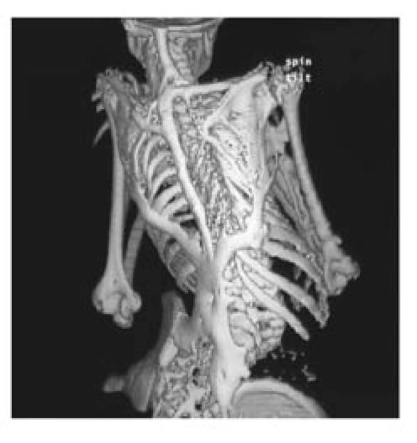 https://cdn.ncbi.nlm.nih.gov/pmc/blobs/5433/3253727/d2e25b3b6cbd/1750-1172-6-80-5.jpg