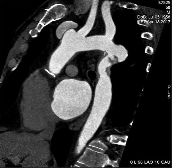 https://cdn.ncbi.nlm.nih.gov/pmc/blobs/5438/6489404/9e219298981f/ACA-22-225-g001.jpg