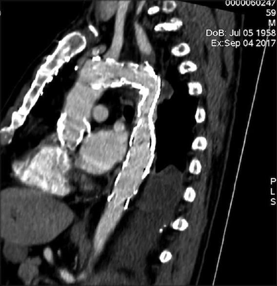 https://cdn.ncbi.nlm.nih.gov/pmc/blobs/5438/6489404/dea03eb8e05b/ACA-22-225-g006.jpg