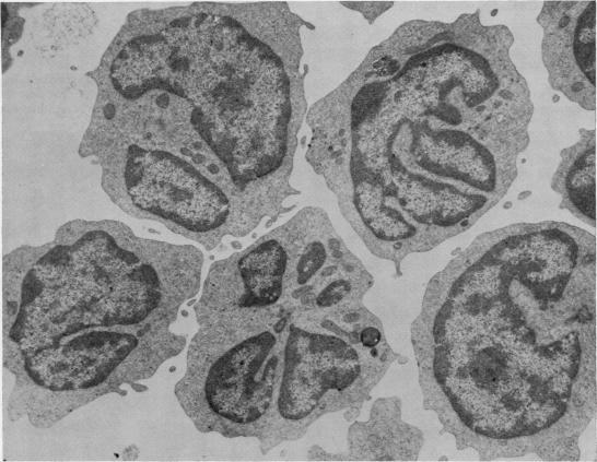 https://cdn.ncbi.nlm.nih.gov/pmc/blobs/543b/1145851/16e875a1a5e0/jclinpath00457-0055-a.jpg
