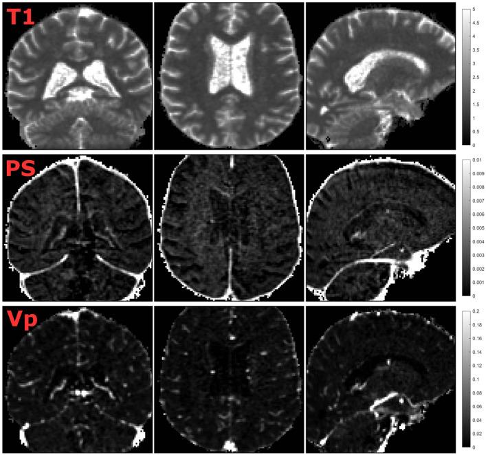 https://cdn.ncbi.nlm.nih.gov/pmc/blobs/5447/11222381/767dc071854f/41598_2024_65944_Fig1_HTML.jpg