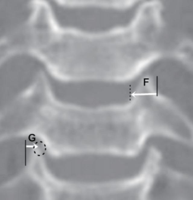 https://cdn.ncbi.nlm.nih.gov/pmc/blobs/5452/6104731/28e41521e64d/ns-1836004-022f2.jpg
