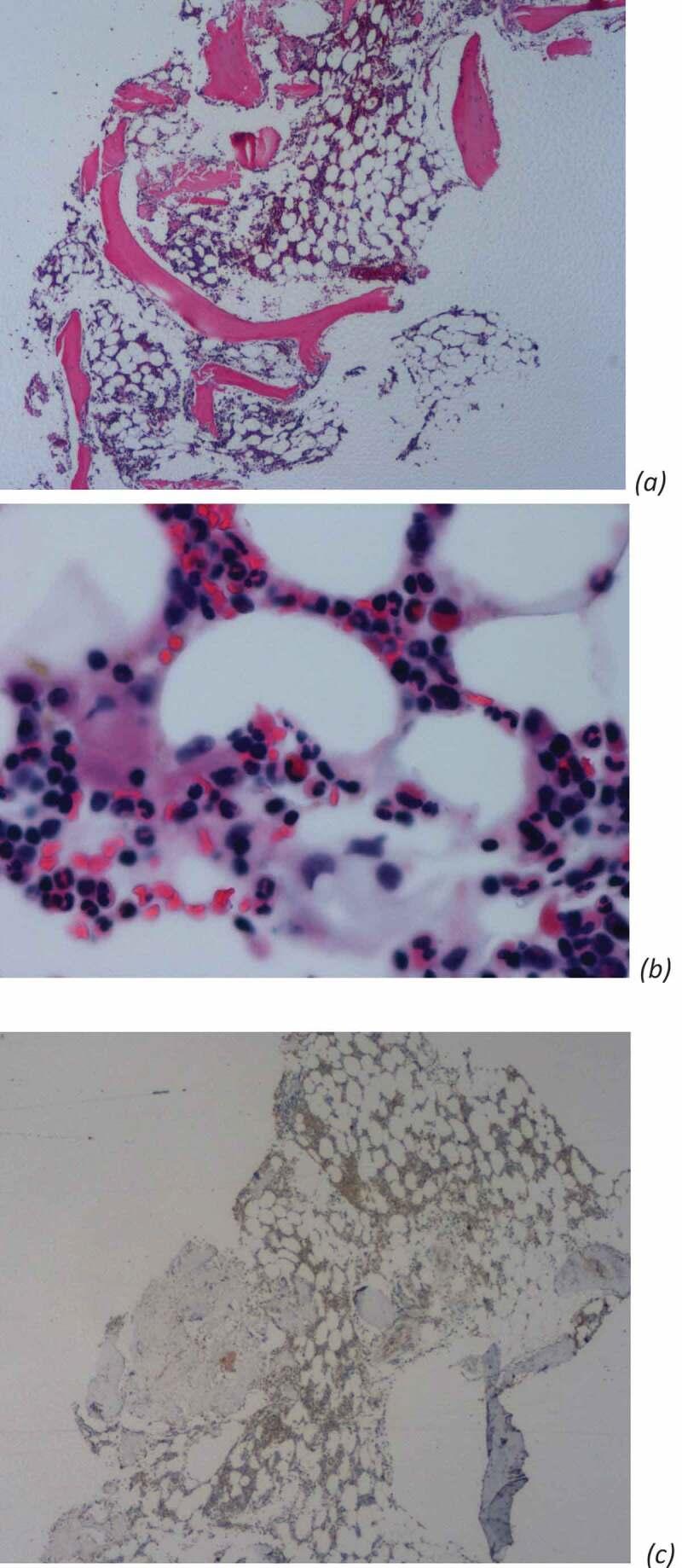 https://cdn.ncbi.nlm.nih.gov/pmc/blobs/5453/7431916/e5ac95564d10/ZJCH_A_1770019_F0002_OC.jpg