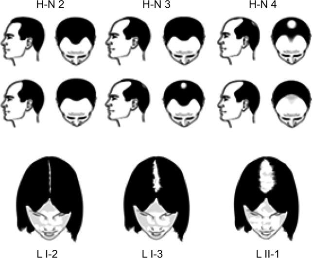https://cdn.ncbi.nlm.nih.gov/pmc/blobs/545e/5338843/1f9ad110a335/ccid-10-071Fig2.jpg