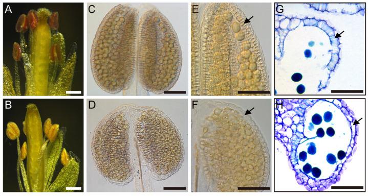 https://cdn.ncbi.nlm.nih.gov/pmc/blobs/5462/11899387/04d70151f44b/ijms-26-01813-g002.jpg