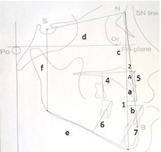 https://cdn.ncbi.nlm.nih.gov/pmc/blobs/5464/4345110/1359bf91b799/jds-16-22-g001.jpg