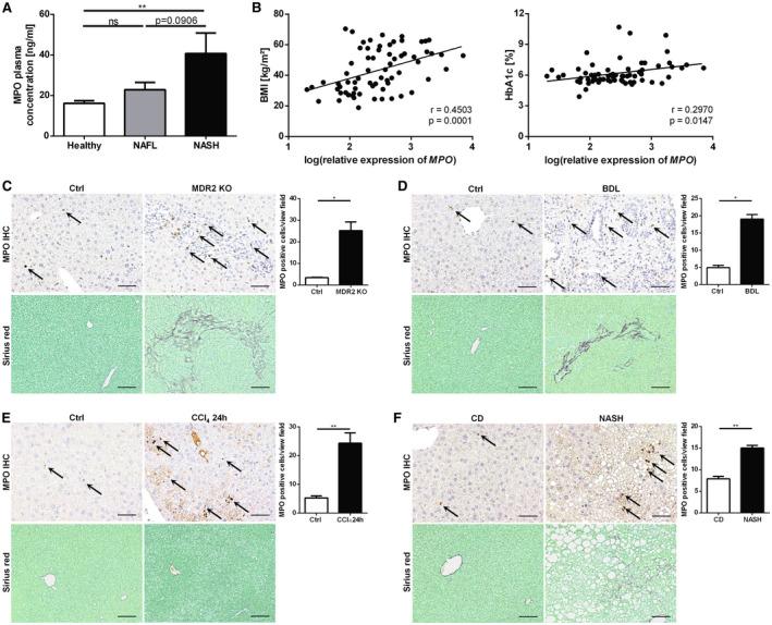 https://cdn.ncbi.nlm.nih.gov/pmc/blobs/5465/7527691/073e785db7aa/HEP4-4-1441-g001.jpg