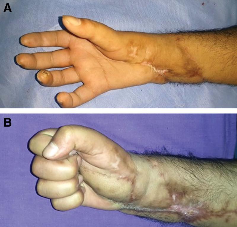 https://cdn.ncbi.nlm.nih.gov/pmc/blobs/546b/8670581/45a4bc6b2372/gox-9-e3949-g006.jpg